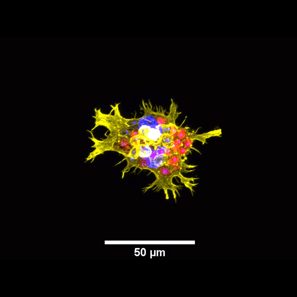 At the beginning there was dark and fear, and then there were macrophages! - Author: Daniel de Lima Bellan. Description: Immortalized lineage macrophage phagocytizing yeast. Its spreads, nucleus and yeasts may seem, to the most enthusiastic observers, like the origin of a galaxy!