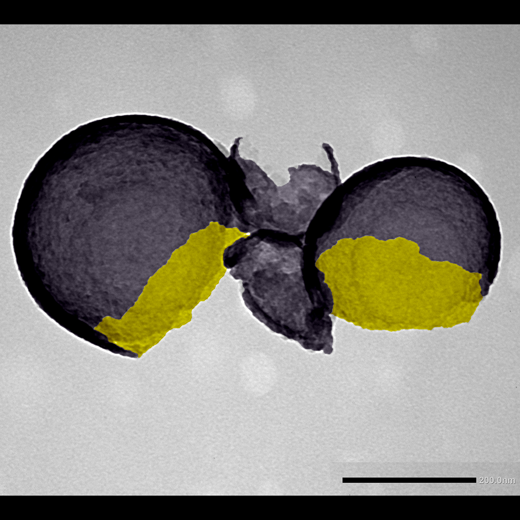 Caution, fragile! - Authors: Yasmin Carla Ribeiro, Anderson Fraga Da Cruz, Jenifer Pendiuk Goncalves, Anny Waloski Robert Kulig, Lia Carolina Almeida Soares de Medeiros, Carolina Camargo de Oliveira. Description: Silica nanocapsules with eosin after ten days in reducing medium simulating the tumor intracellular environment. Image obtained by transmission electron microscopy on a JEOL JEM-1400Plus microscope at Carlos Chagas Institute.