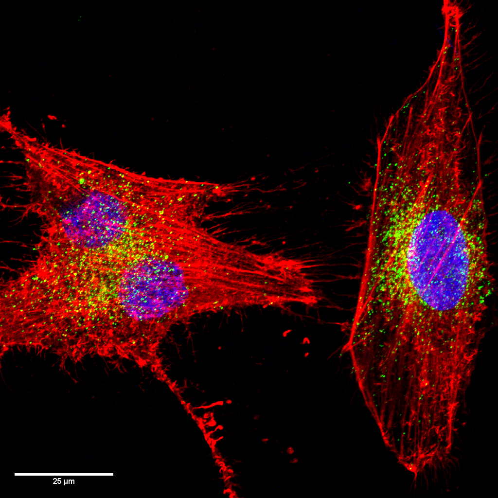 Cell dance - Author: Anderson Fraga da Cruz, Jacqueline Gonçalves dos Santos, Carolina Camargo de Oliveira. Description: Confocal fluorescence microscopy of Sk-Mel 28 human melanoma cells where the actin filaments are labeled with ActinRed (red), the nucleus with DAPI (blue) and the HMB-45 protein labeled with primary anti-HMB-45 antibody and secondary antibody conjugated with AlexaFluor 647 (green, pseudocolor). Image taken at 100x magnification on the A1R MP+ Nikon confocal microscope at the Center for Advanced Fluorescence Technologies at the Federal University of Paraná.