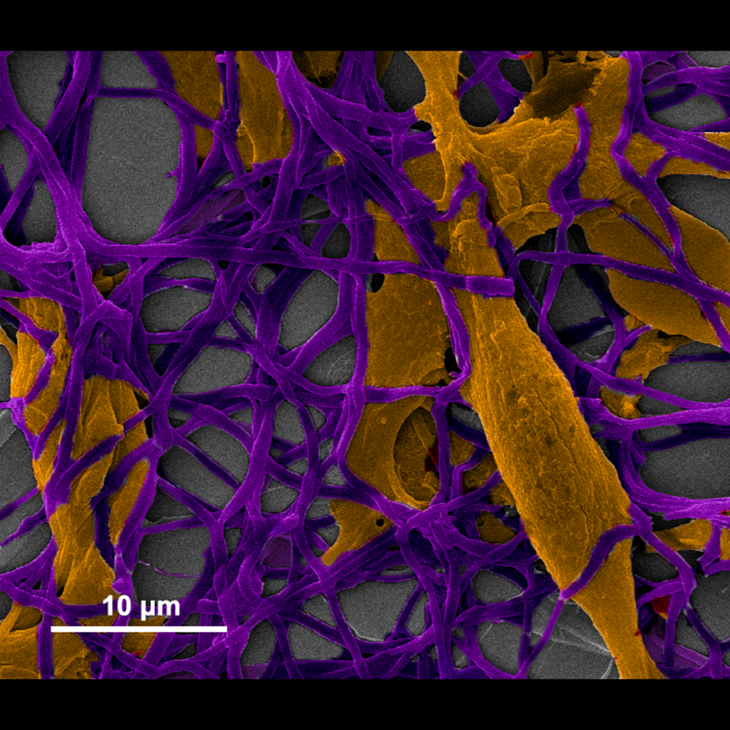 Cellular entanglement - Authors: Anderson Fraga Da Cruz, Carolina Camargo de Oliveira, Izabel Riegel-Vidotti, Sabrina Hochheim. Description: Scanning electron microscopy of BALB/c 3T3 murine fibroblast cells (orange) plated on a zein (maize-derived protein) nanofiber matrix (purple) carrying propolis produced through electrospinning method, used as material for dermal application. It is possible to evaluate adhesion and interaction of cells with fibers. Image obtained with 15kV power and 2000x magnification on the JEOL JSM 6360-LV microscope at the Electron Microscopy Center of the Federal University of Paraná.