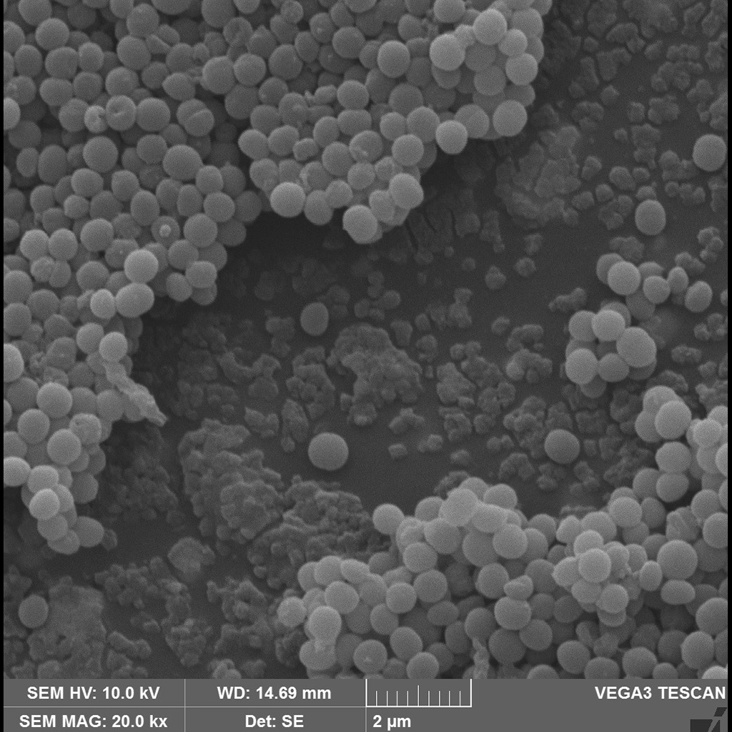Control of bacterial biofilms in central venous catheters using chitosan and silver nanoparticles- Authors: Manuela Nepomuceno Ladeira, Marcos Antonio Polinarski, Felipe Eduardo Bueno Silva, Helton José Alves, Juliana Bernardi Wenzel. Description: Scanning electron microscopy image of a polyurethane central venous catheter test piece with presence of biofilm from the bacteria Staphylococcus aureus ATCC25923 in which the adapted methodology of inhibiting the formation of biofilms with Ch-Ag 6:1 (compound with 150 mg of chitosan and 25 mg of AgNO3 in 55 ml of solution) was used. Covering the catheter, the aforementioned bacteria (in the upper left corner, some of them are dividing) and the extracellular matrix of the bacterial biofilm are seen.