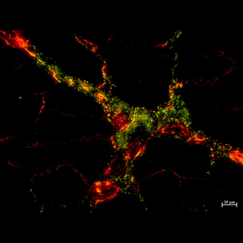 Differentiation of type I and III collagens of muscle wraps - Authors: Matheus Felipe Zazula, Elielton Horlem da Luz, Diego Francis Saraiva Rodriguez, Katya Naliwaiko. Description: Photomicrographs of the plantar muscle of Wistar rats supplemented with excess omega 3 during development. Cross sections obtained in a cryostat chamber, 5 µm thick, stained using the picrosirius red technique. Through polarized light microscopy, it is possible to observe the presence of type I collagen (red) and type III collagen (green). Due to the thick structure of type III collagen, light passing through this molecule refracts at wavelengths in the green spectrum (500 – 565 nm). While when passing through type I collagen, it is less thick and refracts at wavelengths in the red spectrum (625 – 740 nm).
