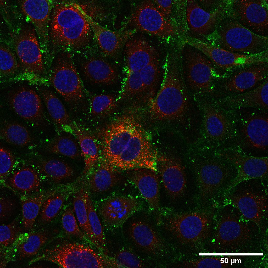 In search of the intracellular fate of Phospholipases-D: Lysosomes - Authors: Hanna Câmara da Justa, Luiza Helena Gremski, Silvio S. Veiga. Description: Phospholipase-D toxin from Loxosceles spider venom triggers skin symptoms such as dermonecrosis. The aim of the assay was to investigate direct interaction with endothelial cells. Therefore, the targeting of this toxin (intracellularly) upon contact with an endothelial cell (RAEC) was analyzed. In immunofluorescence, labeling for the nucleus (DAPI) and labeling for phospholipase-D (green) can be observed, suggesting a subtle colocalization with lysosomes (red). Therefore, it can be suggested that within 3 hours of contact, a small part of the PLD can be directed to lysosomes, and another part can be endocytosed and directed to other organelles and/or vesicles.