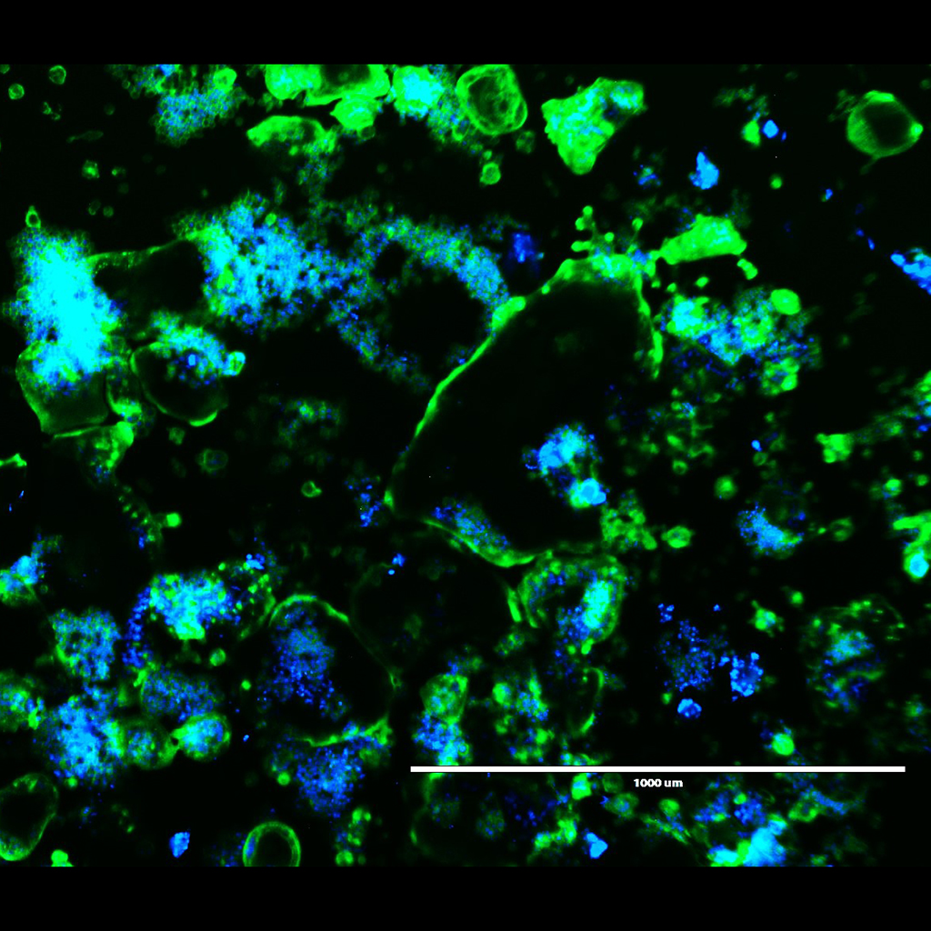 Osteoclasts, the royal victories of cell biology - Authors: Iolanda Augusta Fernandes De Matos, Morgana Rodrigues Guimaraes Stabili. Description: Osteoclasts grow and fulfill their role in bone resorption, various stimuli are capable of making them mature, and from that moment on they become a key part of bone turnover. On the other hand, its exacerbated growth causes changes that deregulate this process, degrading uncontrolled bone matrix. Royal victories are the same way, in the environment in which they develop they help in the microenvironment, with nutrients, temperature balance, reproduction of some animals and others, but their disordered growth, triggers competition for food, light and oxygen, this destabilization can cause even the death of restricted environments. Water lilies and osteoclasts are similar, not only in shape, but also in their specific functions and microenvironment renewal.