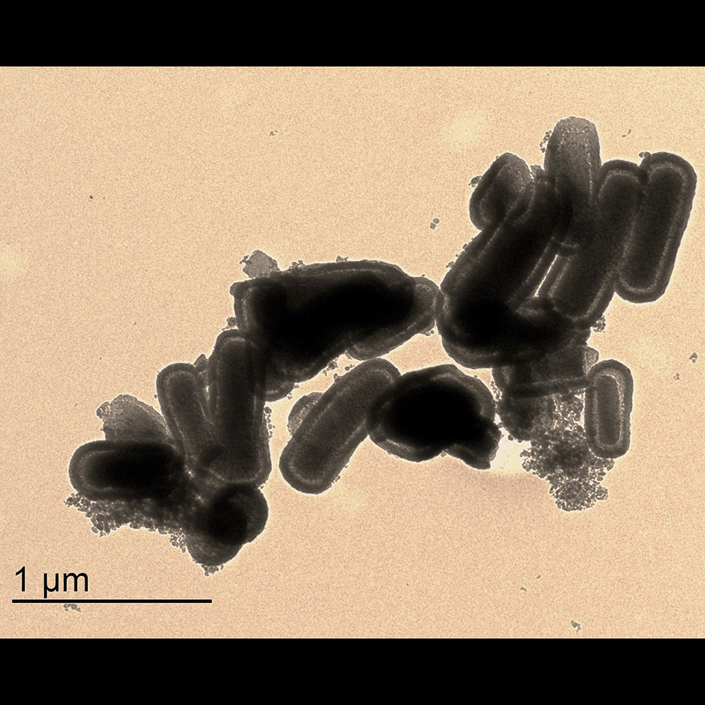 Pseudobacillus - Authors: Renata Pinho Morais, Cláudia E. B. Marino, Izabel Riegel Vidotti. Description: The image “Pseudobacillus”, in fact, does not represent bacteria of the genus Bacillus, it shows the morphology of silica nanorods, hence “pseudo”. Silica nanorods have a rod shape, similar to bacteria of the Bacillus genus. These silica nanorods were synthesized to produce a new drug delivery system, which can be used to deliver bioactive substances to cells more efficiently and with greater specificity than traditional medicines. The image was obtained by Transmission Electron Microscopy on a JEOL JEM 1200EX-II device with 10kx magnification.
