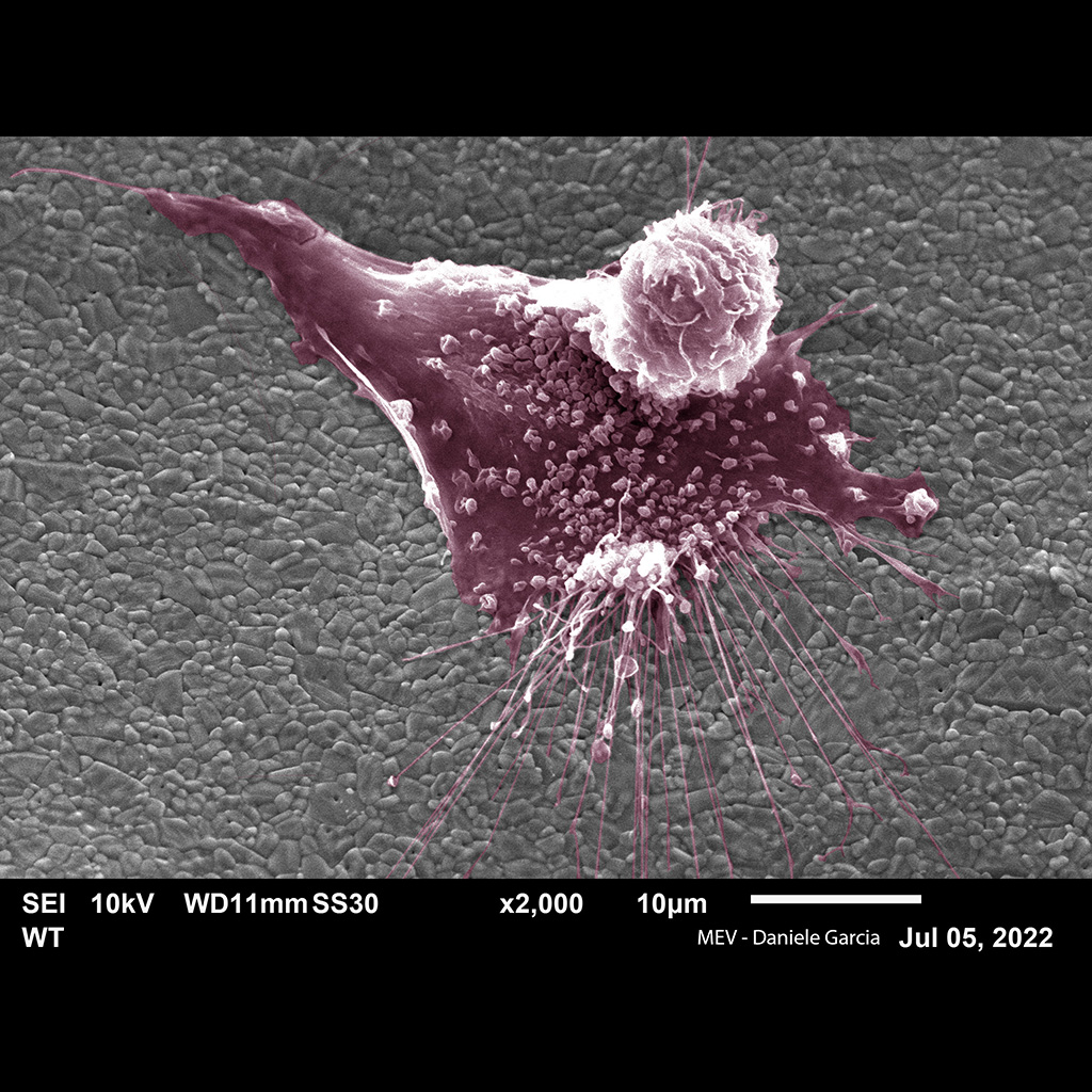 The Stem Cell Journey - Authors: Daniele De Freitas Garcia, Bruna Hilzendeger Marcon, Alejandro Correa Dominguez. Description: Scanning electron microscopy of a Mesenchymal Stem Cell isolated from human adipose tissue and cultured on the 3D Alumina scaffold. In the image it is possible to visualize the cell in its process of adhering to the biomaterial through its membrane extensions.