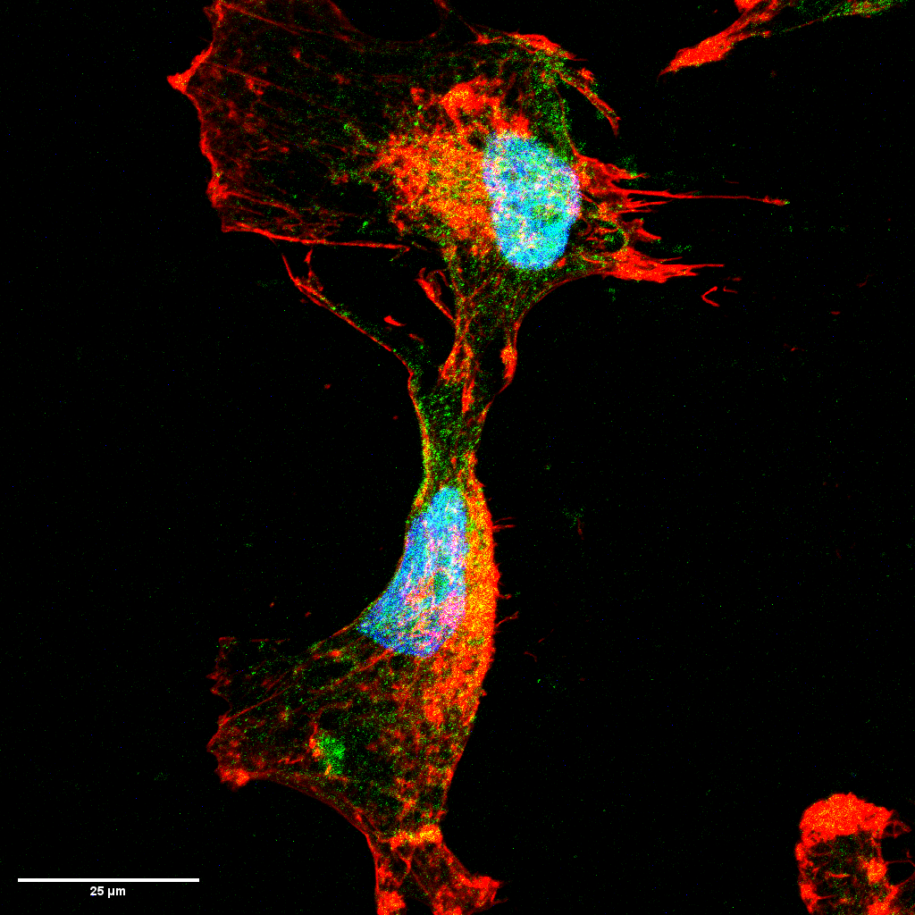 Woodpecker - Authors: Kaique Siqueira Silva, Anderson Fraga da Cruz, Jacqueline Gonçalves dos Santos, Carolina Camargo de Oliveira. Description: Confocal fluorescence microscopy of CHL-1 human melanoma cells. Where actin filaments (cytoskeleton) are labeled with ActinRed (red), nucleus with DAPI (blue) and HMB-45 protein labeled with anti-HMB-45 primary antibody and secondary antibody conjugated with AlexaFluor 647 (green, pseudocolor). Image obtained at 100x magnification on the A1R MP+ Nikon confocal microscope at the Center for Advanced Fluorescence Technologies at Federal University of Paraná.