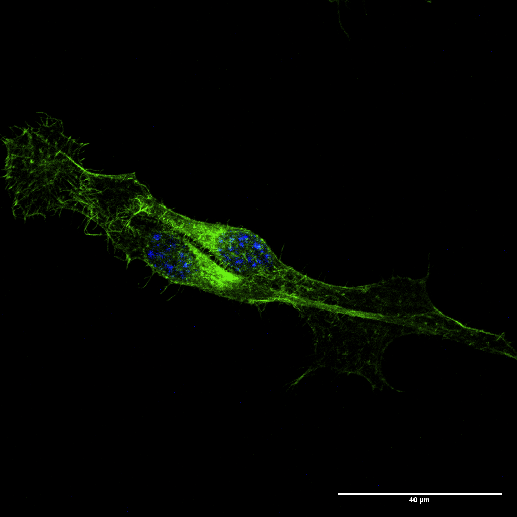 Yin Yang Tumor – Authors: Yasmin Carla Ribeiro, Jacqueline Santos, Carolina Camargo de Oliveira, Edvaldo da Silva Trindade. Description: B16-F10 melanoma cells treated with gold nanoparticles subjected to transwell invasion assay with matrigel, labeled with actin-green (cytoskeleton) and DAPI (nucleus). Image obtained after 72 hours of invasion on a Nikon A1R MP+ confocal microscope at the Center for Advanced Fluorescence Technologies – CTAF/UFPR.